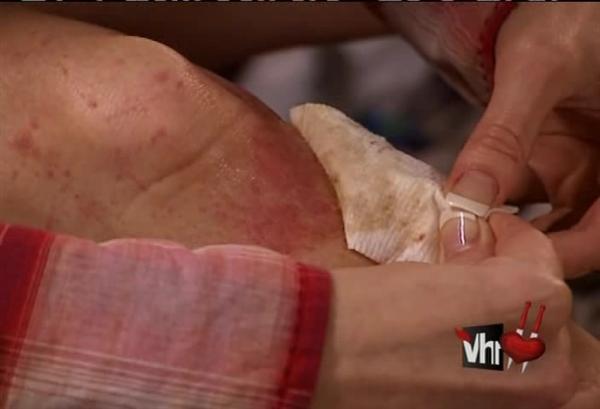 black and blue and broken bones, you left me here, now I'm looking to use this to advance my career black and blue and broken bones, you left me here, now I'm looking to use this to advance my career